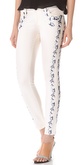 GENET40162