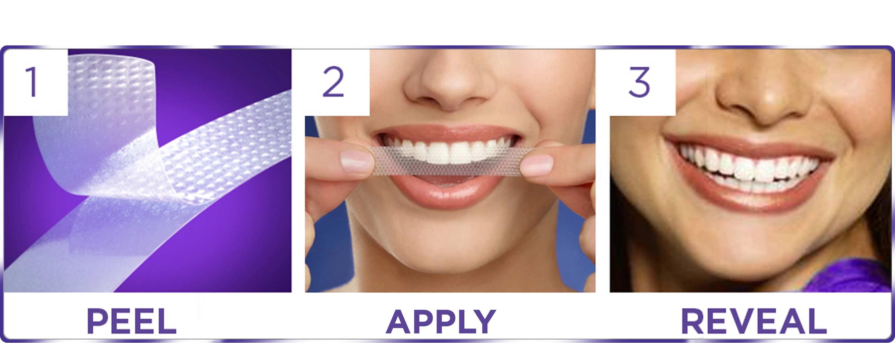 Do whitening strips damage your teeth?