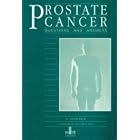 Prostate Cancer: Questions and Answers by A. Colin Buck