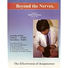 Beyond the Nerves: The Effectiveness of Acupuncture by 