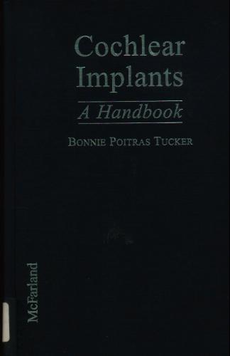 Cochlear Implants: A Handbook