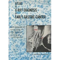 Atlas of X-Ray Diagnosis of Early Gastric Cancer