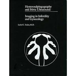 Hysterosalpingography and Pelvic Ultrasound: Imaging in Infertility and Gynecology by Isabel Yoder