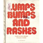 Lumps, Bumps and Rashes: A Look at Kids' Diseases (The First Book of Series) by  Alan Edward Nourse