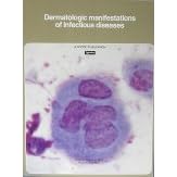 Dermatologic manifestations of infectious diseases (A Scope publication) by  Phillip K. Peterson and Mark V. Dahl