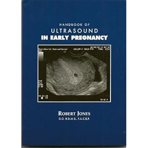 Handbook of Ultrasound in Early Pregnancy by Robert Jones