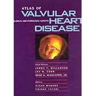 Click here to buy Atlas of Valvular Heart Disease: Clinical and Pathologic Aspects by James T. Willerson, Jay N. Cohn, Hugh A. McAllister, and Hisao Manabe.