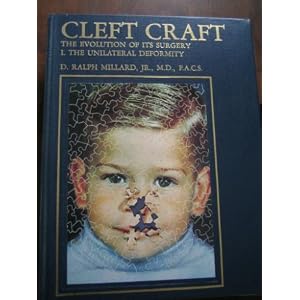 Click here to buy Cleft Craft. The Evolution of Its Surgery. I: The Unilateral Deformity (Vol 1) by D. Ralph Millard.