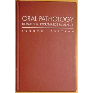 Click here to buy Oral Pathology by Donald A. Kerr and Major M. Ash.