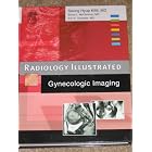Click here to buy Radiology Illustrated: Gynecologic Imaging (Radiology Illustrated) by Seung Hyup Kim, Bruce McClennan, and Eric Outwater.