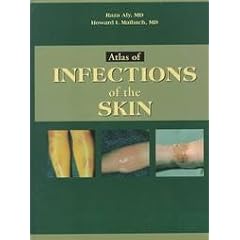 Atlas of Infections of the Skin