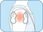 Deltoid