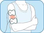 Upper Arm