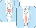 Calf