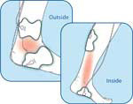 Ankle/Foot
