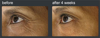 Clinical Image