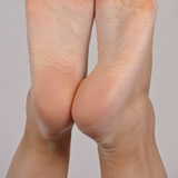 After using the Micro-Pedi for one week