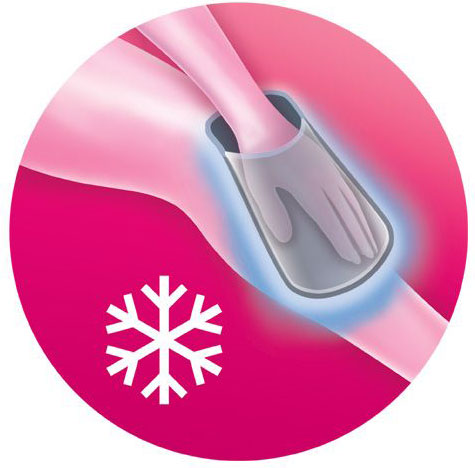 Ice glove