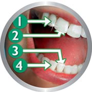 Encourages thorough brushing of each quadrant of the mouth.