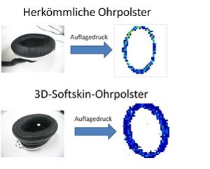 Softskin