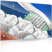 Hervorragende Plaque Entfernung