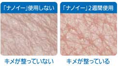 Panasonic �i�m�C�[�����@ (��1��) �N���[���u���b�N F-GMG01-K